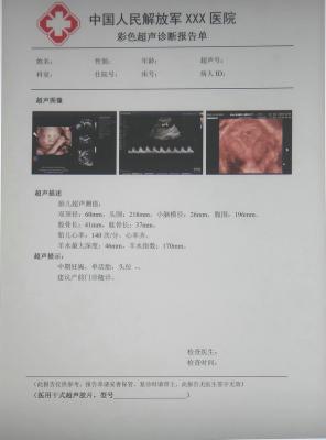 kg/jw-125醫用干式膠片