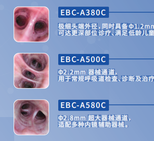 優億一次性電子支氣管鏡ebc-a380c